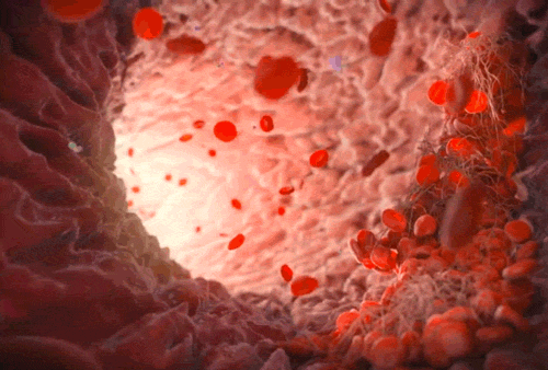 Artificial blood