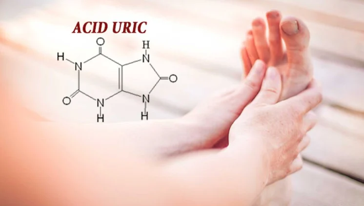 High blood uric acid: 7 things to know for early detection