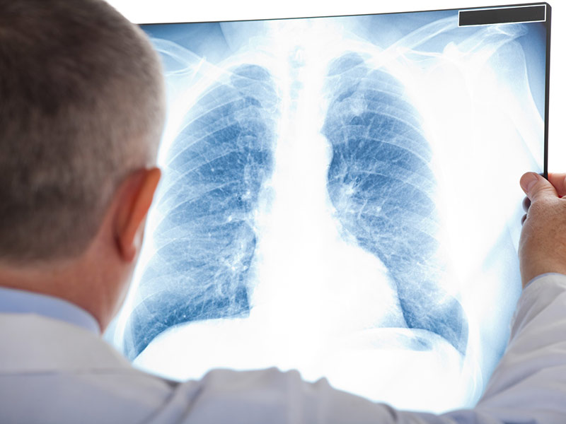 How to Protect the Health of Older Adults