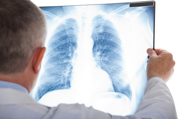 Regular check-ups help detect disease while it is still mild