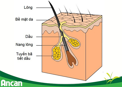 Sebum that cannot escape gradually builds up into a cyst