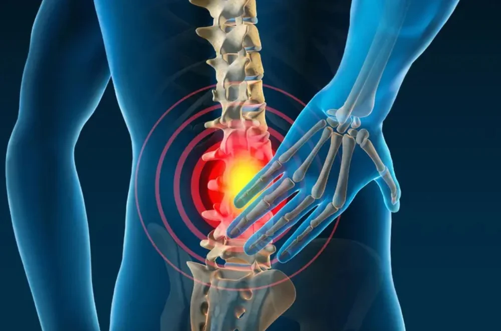Lower back pain: common causes and when to see a doctor