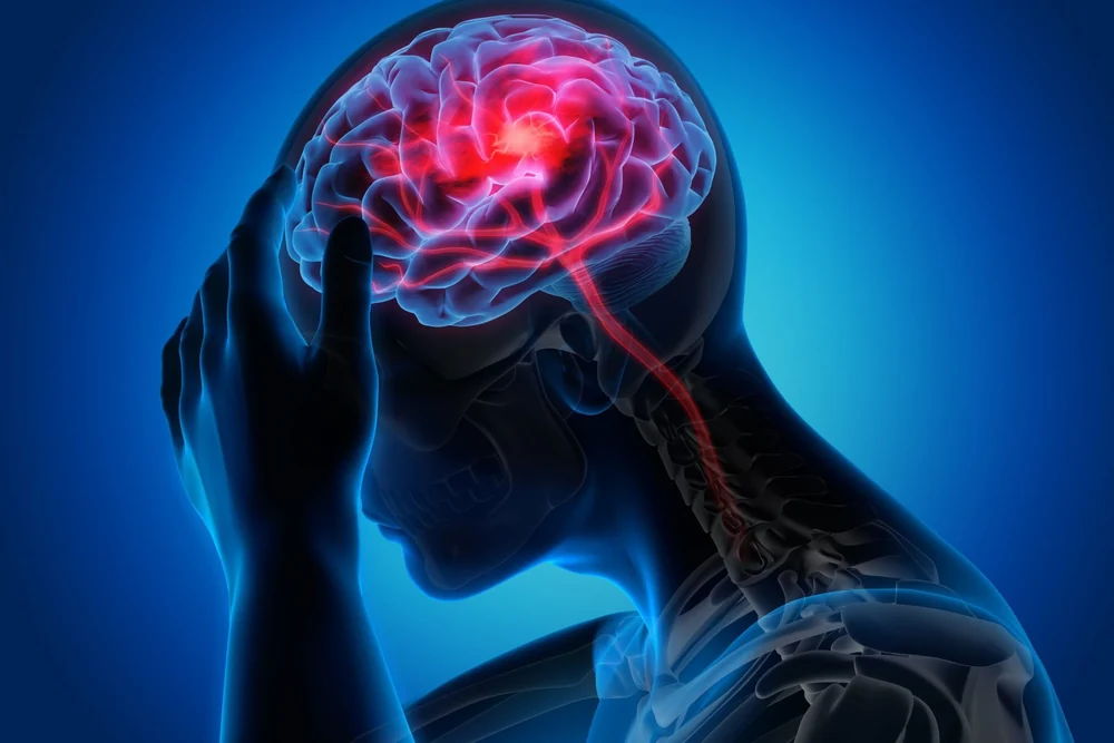 Recurring migraine: which signs mean you should see a doctor?