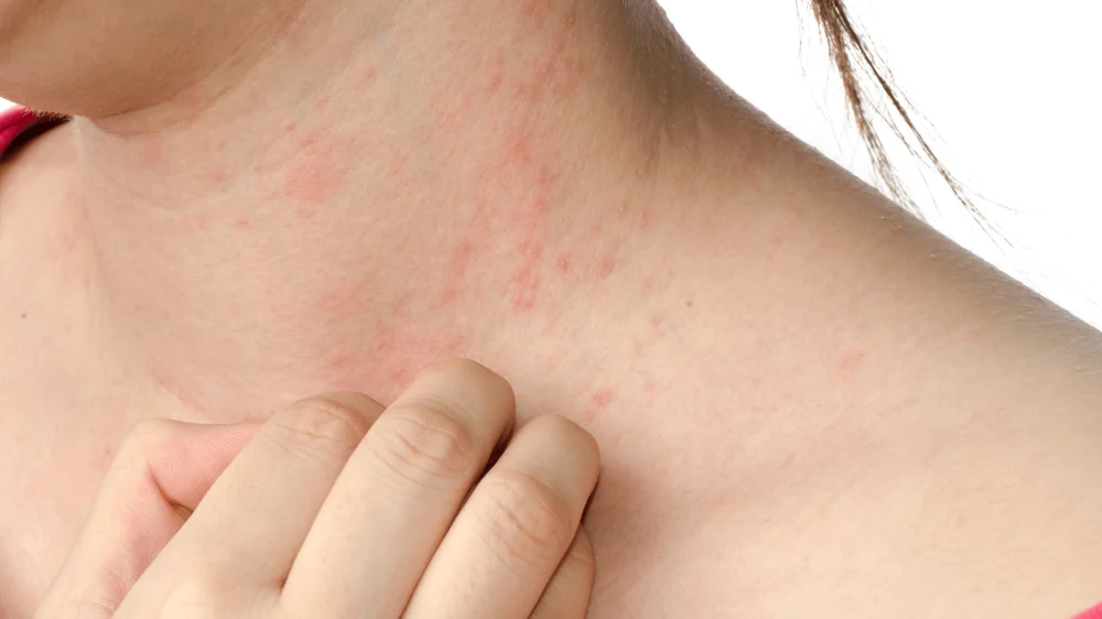 Persistent itching with no clear cause: when should you see a doctor?