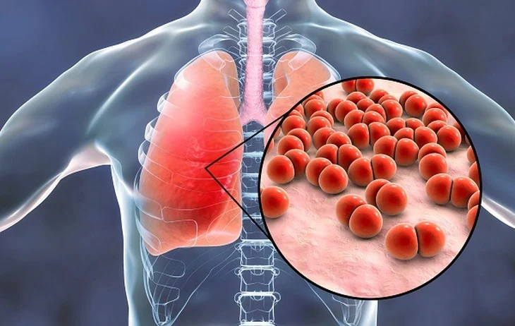 Can pneumonia in older adults spread to other family members?