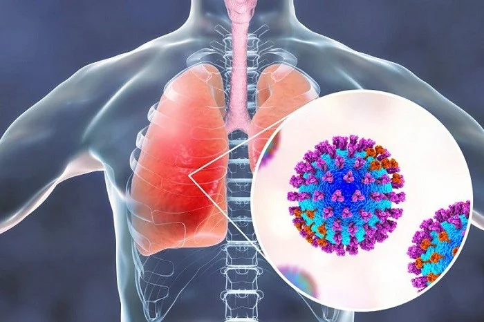 Pneumonia in children: counting breaths and early warning signs